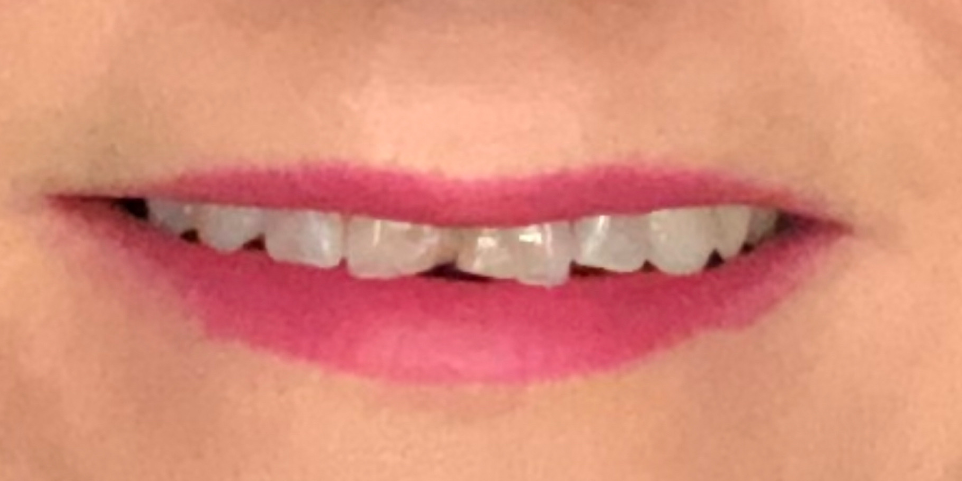 Northwest Villages Dentistry - Vesna Arezina DDS Northwest Villages Dentistry - Vesna Arezina DDS