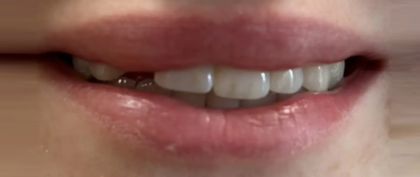 Northwest Villages Dentistry - Vesna Arezina DDS Northwest Villages Dentistry - Vesna Arezina DDS