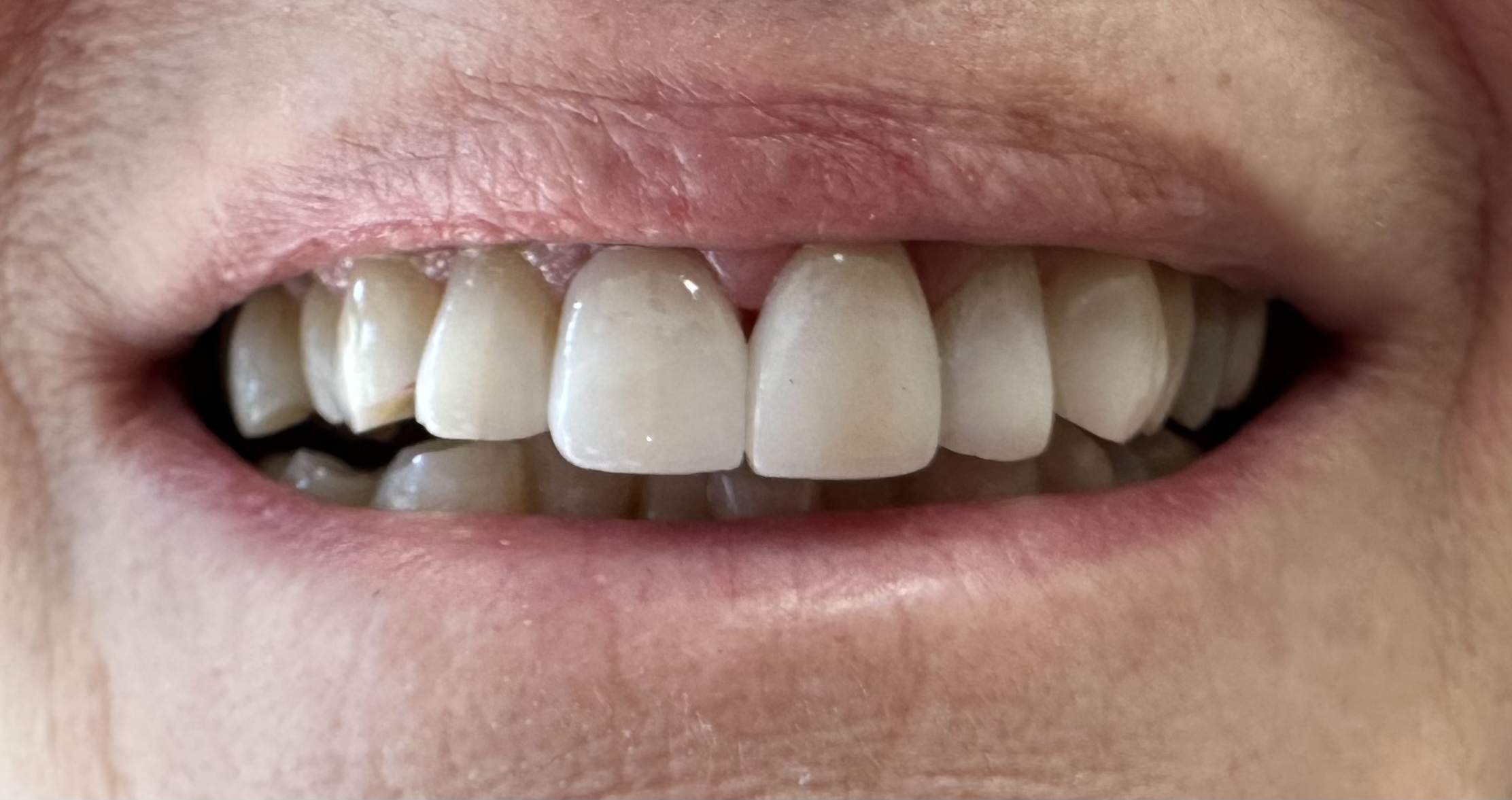 Northwest Villages Dentistry - Vesna Arezina DDS Northwest Villages Dentistry - Vesna Arezina DDS