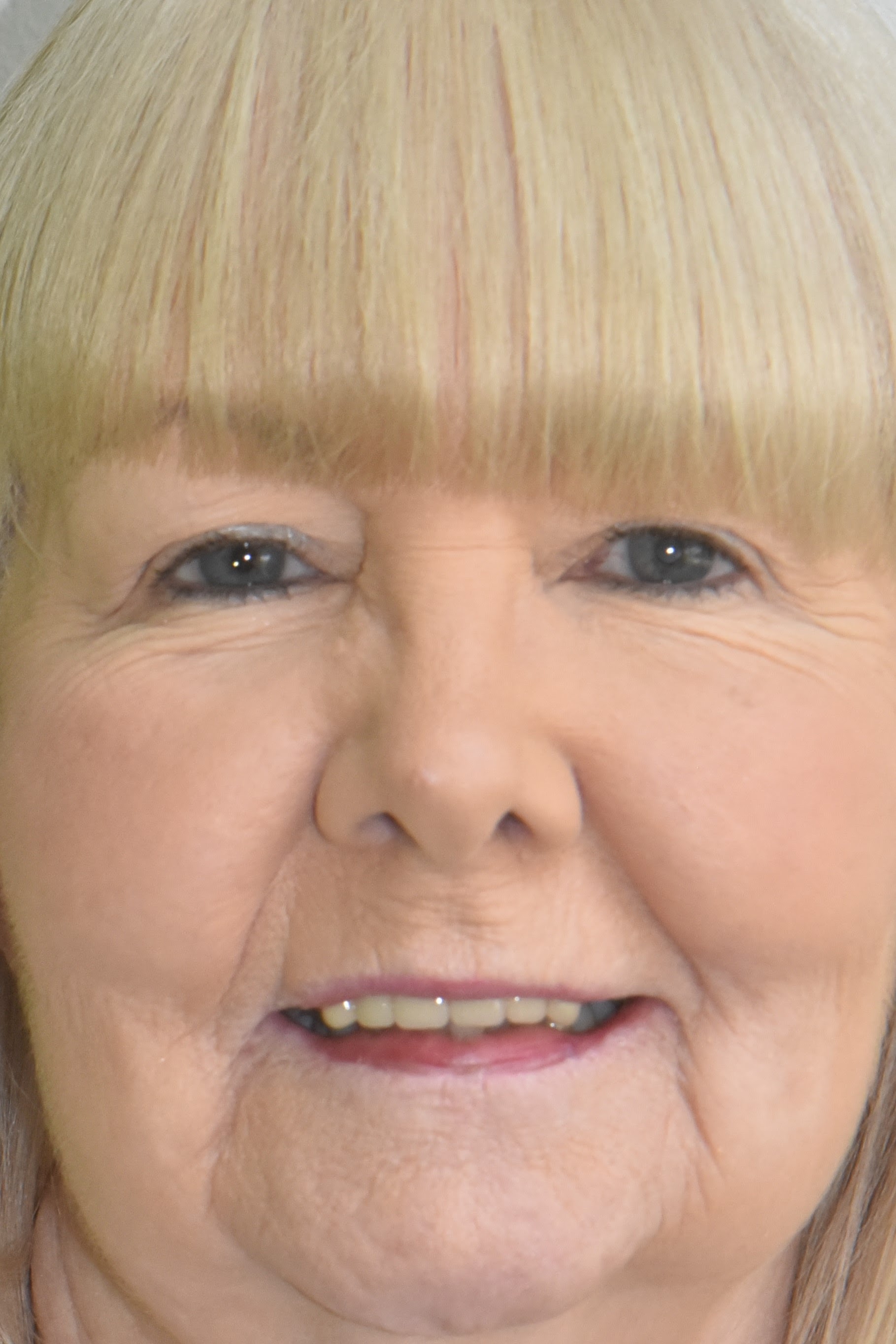 Northwest Villages Dentistry - Vesna Arezina DDS Northwest Villages Dentistry - Vesna Arezina DDS
