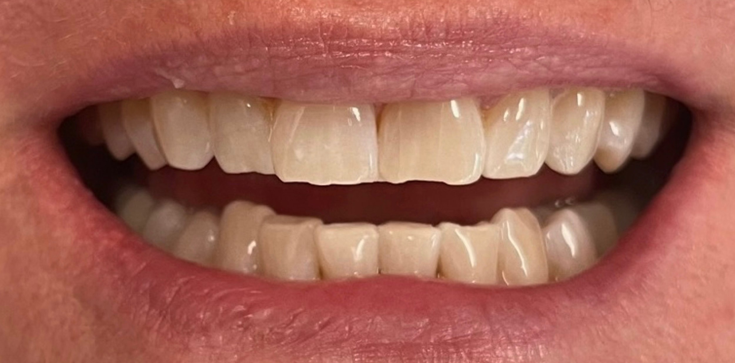 Northwest Villages Dentistry - Vesna Arezina DDS Northwest Villages Dentistry - Vesna Arezina DDS