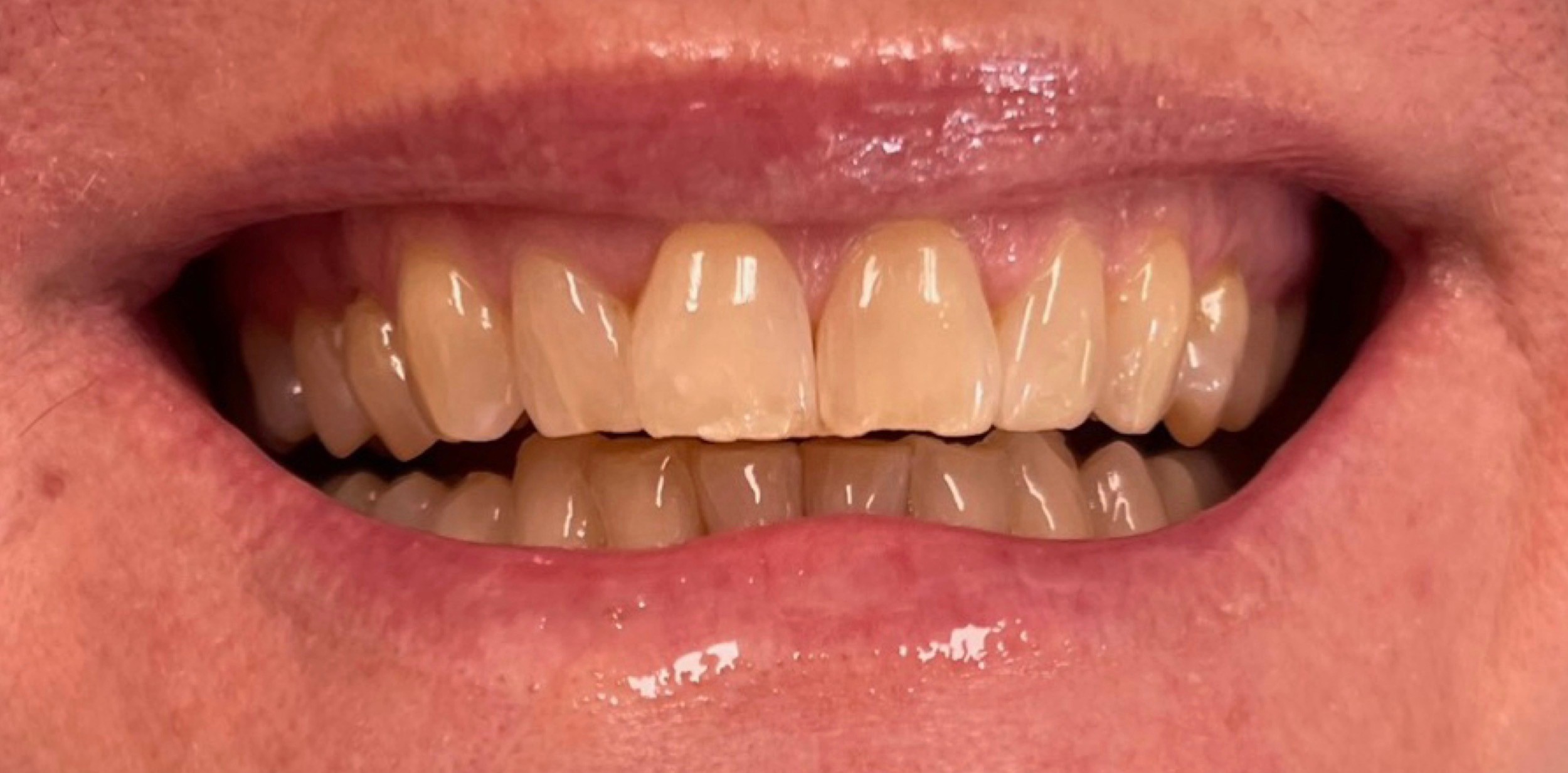 Northwest Villages Dentistry - Vesna Arezina DDS Northwest Villages Dentistry - Vesna Arezina DDS