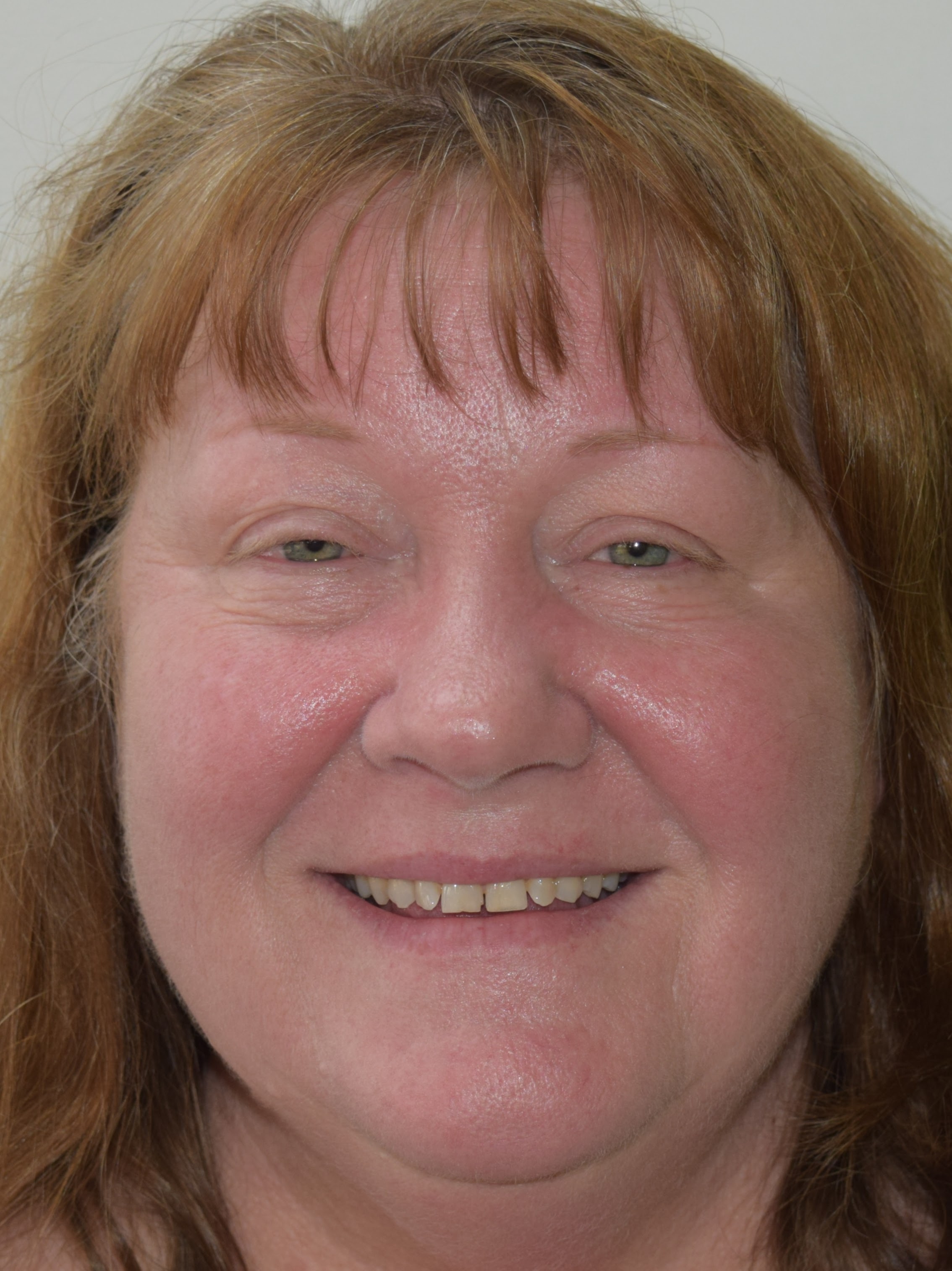 Northwest Villages Dentistry - Vesna Arezina DDS Northwest Villages Dentistry - Vesna Arezina DDS