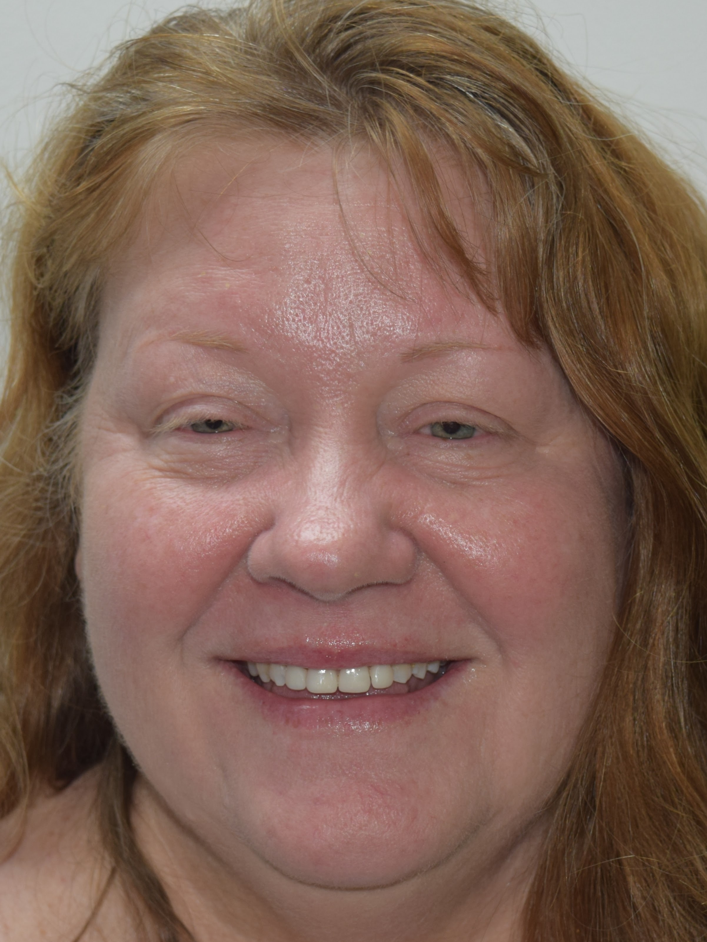 Northwest Villages Dentistry - Vesna Arezina DDS Northwest Villages Dentistry - Vesna Arezina DDS