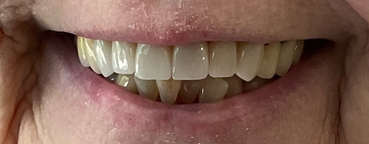 Northwest Villages Dentistry - Vesna Arezina DDS Northwest Villages Dentistry - Vesna Arezina DDS