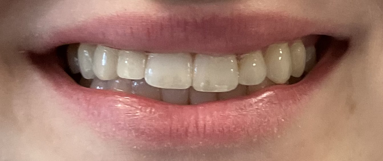 Northwest Villages Dentistry - Vesna Arezina DDS Northwest Villages Dentistry - Vesna Arezina DDS