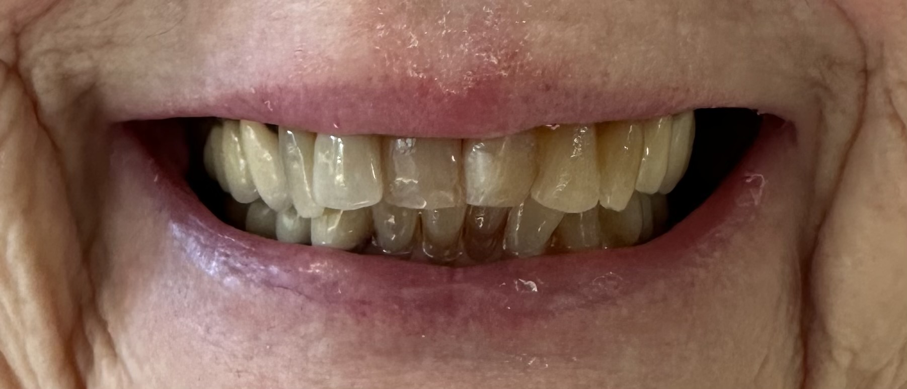 Northwest Villages Dentistry - Vesna Arezina DDS Northwest Villages Dentistry - Vesna Arezina DDS