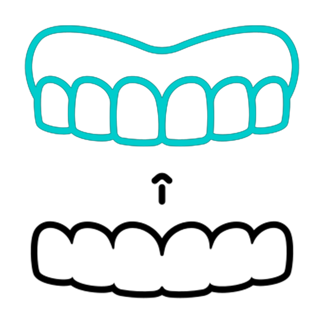 Invisalign