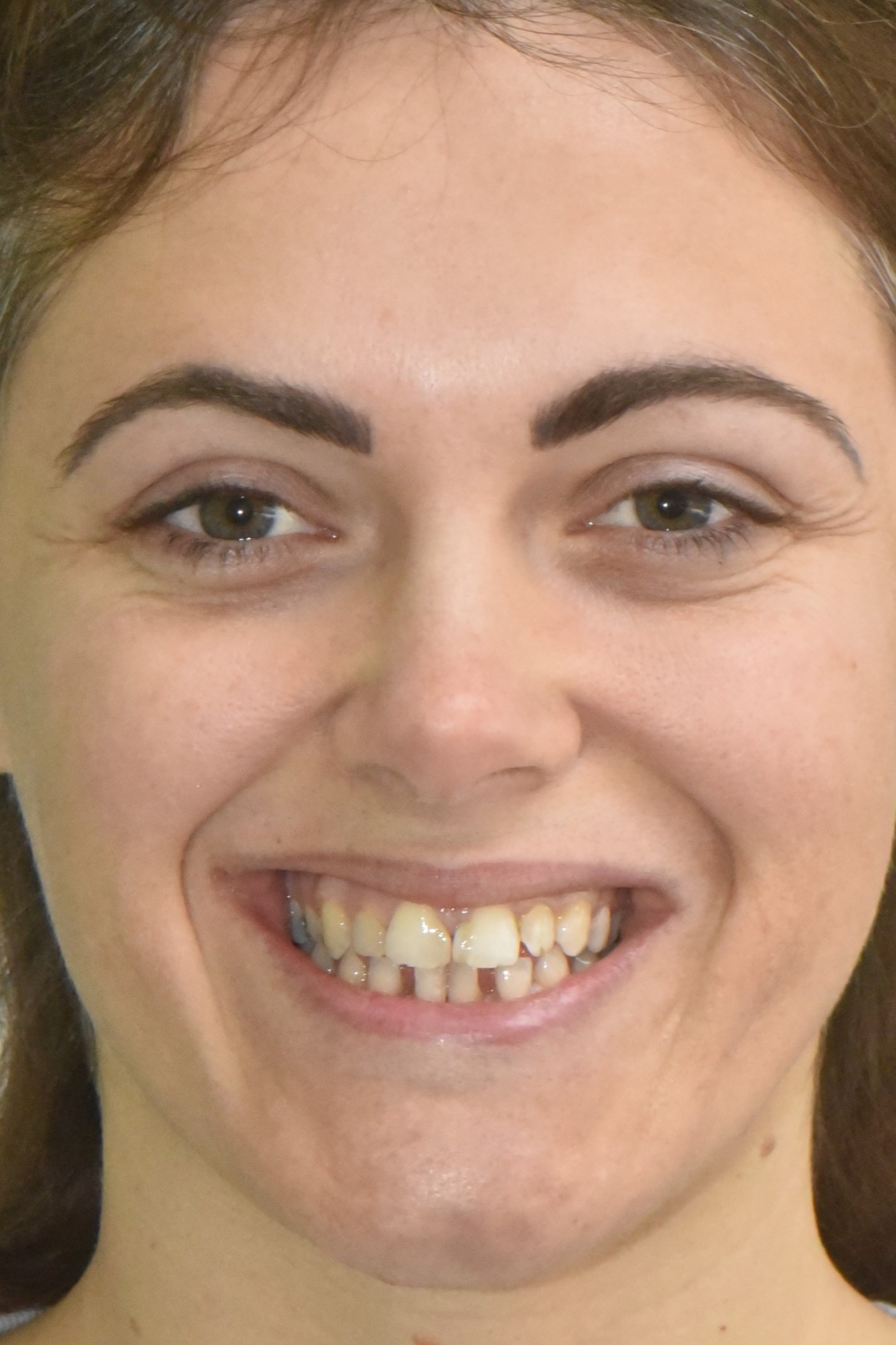 Northwest Villages Dentistry - Vesna Arezina DDS Northwest Villages Dentistry - Vesna Arezina DDS