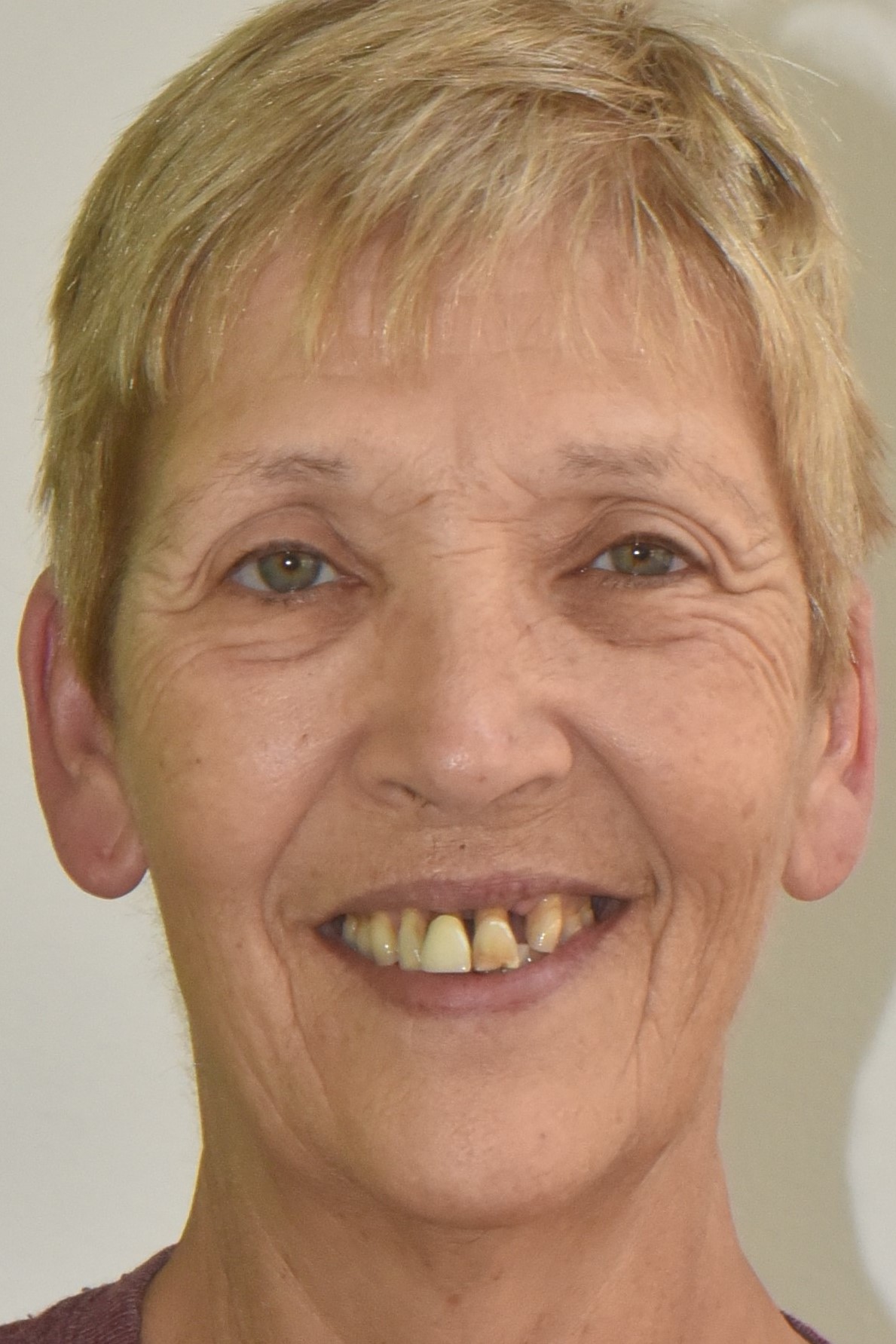 Northwest Villages Dentistry - Vesna Arezina DDS Northwest Villages Dentistry - Vesna Arezina DDS