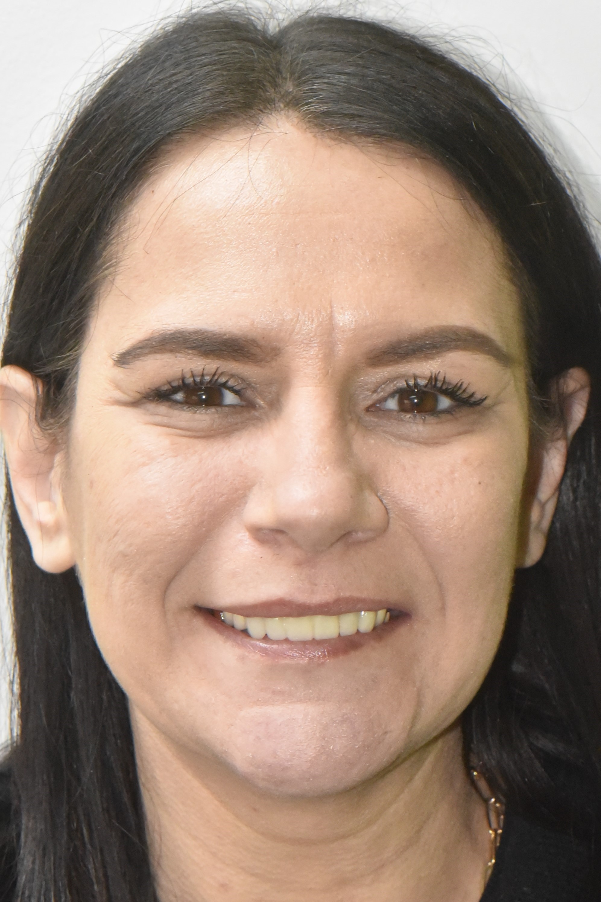 Northwest Villages Dentistry - Vesna Arezina DDS Northwest Villages Dentistry - Vesna Arezina DDS